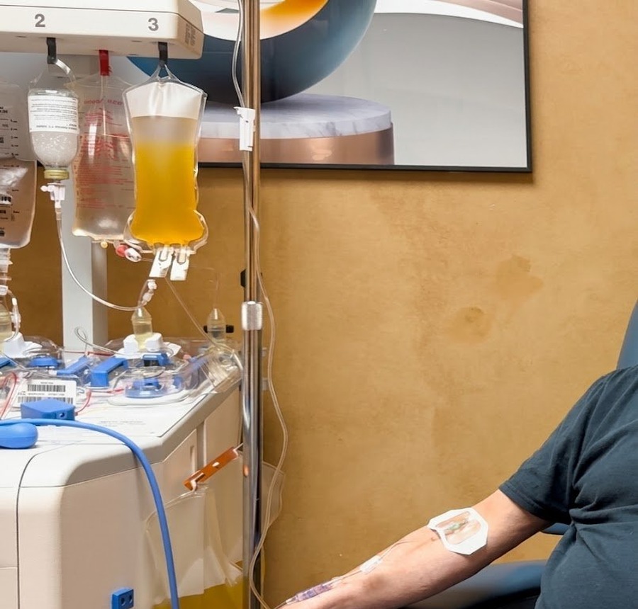 Patient receiving therapeutic plasma exchange under clinical supervision